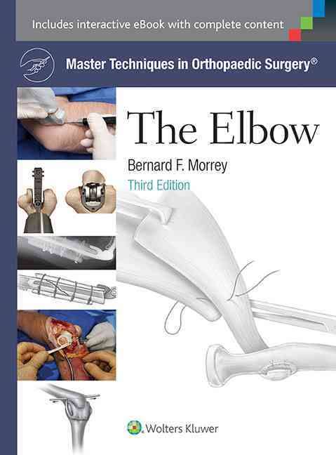 Master Techniqes in Orthopaedic Surgery