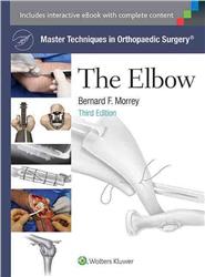Cover Master Techniqes in Orthopaedic Surgery