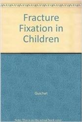 Cover Fracture Fixation in Children
