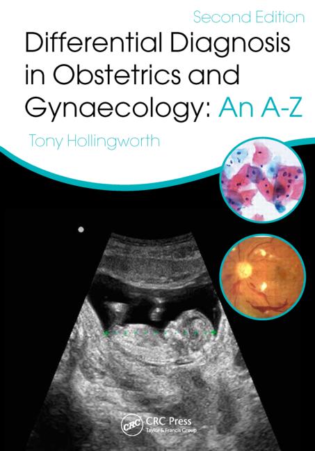 Differential Diagnosis in Obstetrics and Gynaecology