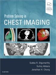 Cover Problem Solving in Chest Imaging