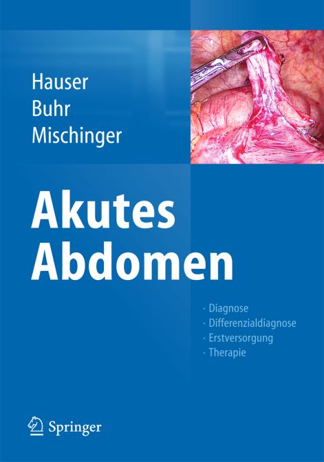 Akutes Abdomen