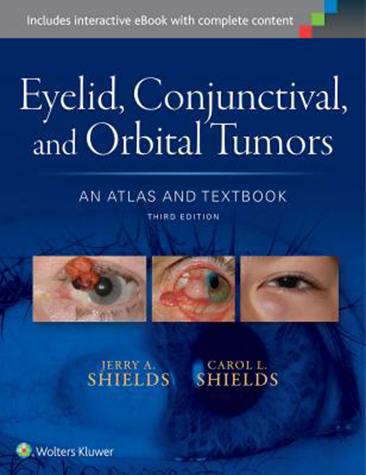 Atlas of Eyelid & Conjunctival Tumors