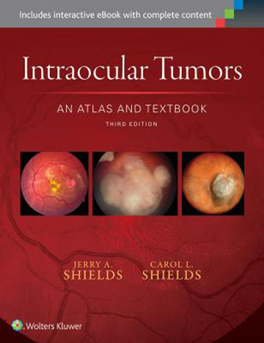 Atlas of Intraocular Tumors