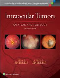 Cover Atlas of Intraocular Tumors