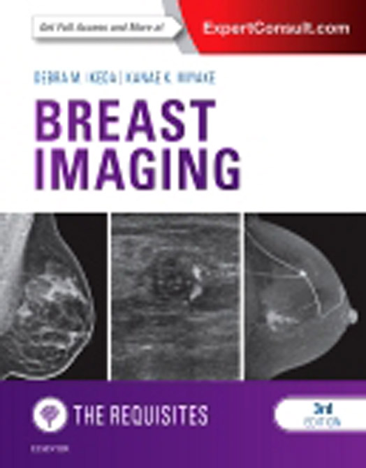 Breast Imaging