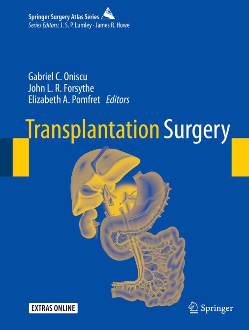 Transplantation Surgery