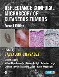 Cover Reflectance Confocal Microscopy of Cutaneous Tumors