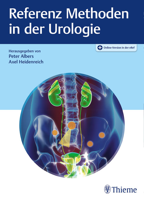 Referenz Urologie - Operationsmethoden