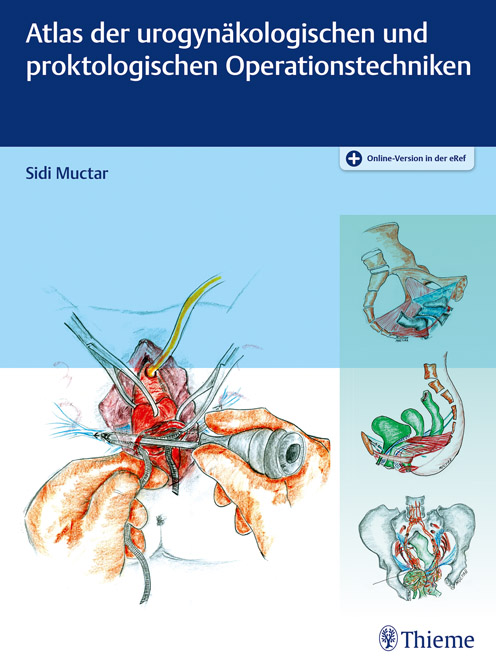 Atlas der urogynäkologischen und proktokologischen Operationstechniken