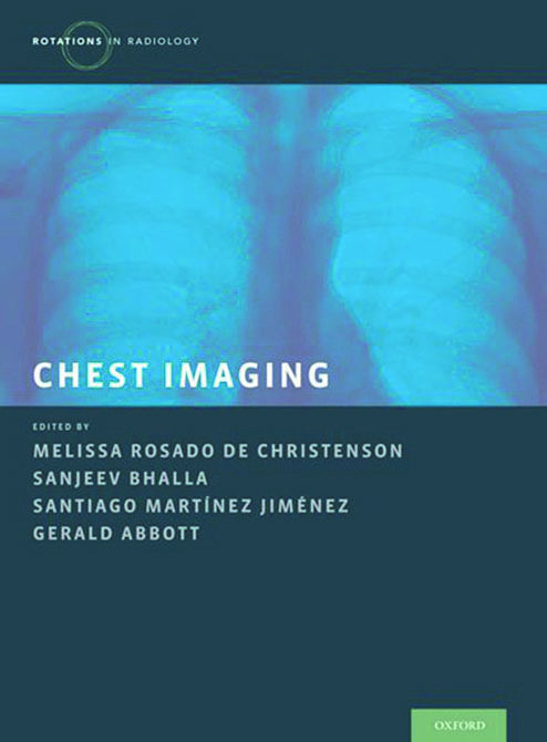 Chest Imaging