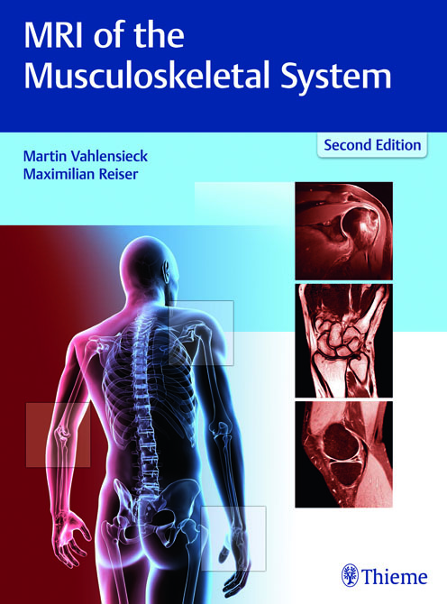 MRI of the Musculoskeletal System