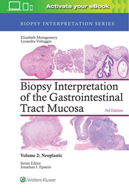 Biopsy Interpretation of the Gastrointestinal Tract Mucosa.