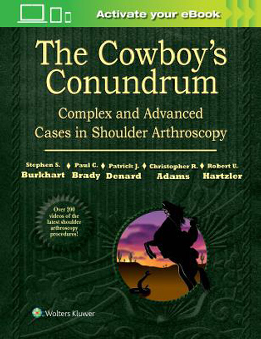 The Cowboys Conundrum: Complex and Advanced Cases in Shoulder Arthroscopy