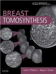 Cover Breast Tomosynthesis