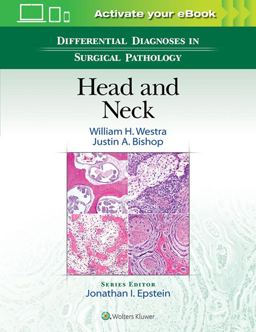 Differential Diagnoses in Surgical Pathology: Head and Neck