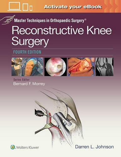 Reconstructive Knee Surgery