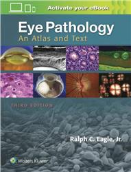 Cover Eye Pathology