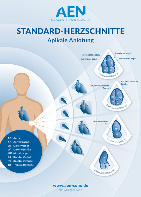 Standard-Herzschnitte Echokardiografie / Poster