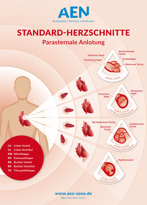 Standard-Herzschnitte Echokardiografie / Poster