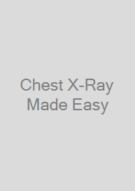 Chest X-Ray Made Easy