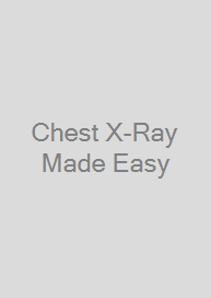 Cover Chest X-Ray Made Easy