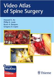 Cover Video Atlas of Spine Surgery