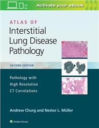 Cover Atlas of Interstitial Lung Disease Pathology