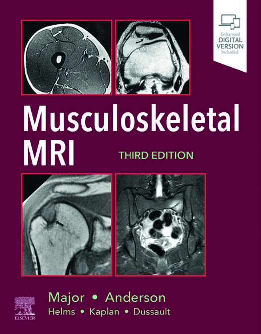 Musculoskeletal MRI