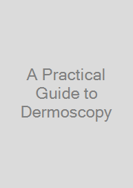 A Practical Guide to Dermoscopy