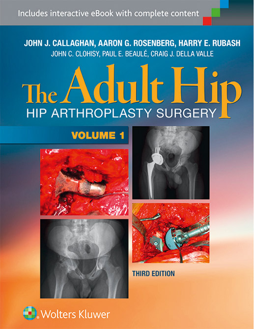 The Adult Hip. 2 Volumes