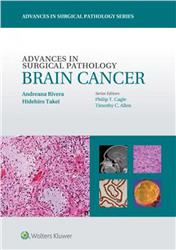 Cover Advances in Surgical Pathology: Brain Cancer
