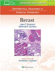 Cover Differential Diagnoses in Surgical Pathology: Breast