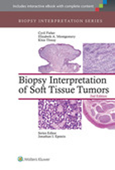 Biopsy Interpretation of Soft Tissue Tumors