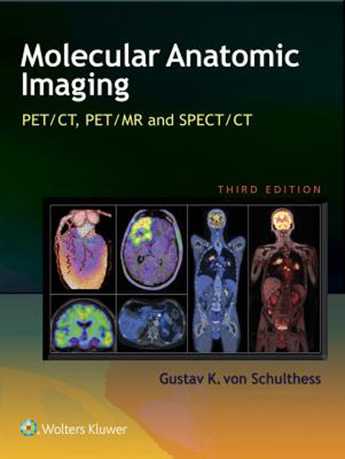 Clinical Molecular Anatomic Imaging - PET, PET/CT, and SPECT/CT