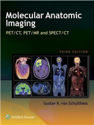 Cover Clinical Molecular Anatomic Imaging - PET, PET/CT, and SPECT/CT