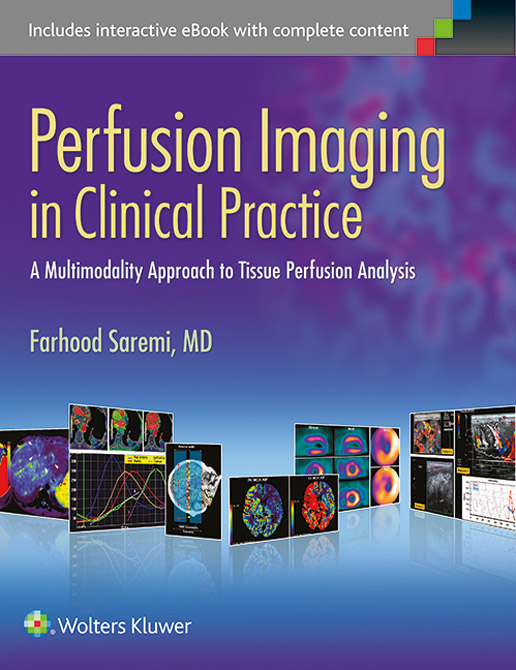 Perfusion Imaging in Clinical Practice