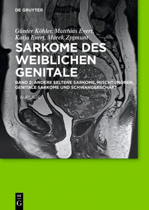 Sarkome des weiblichen Genitale