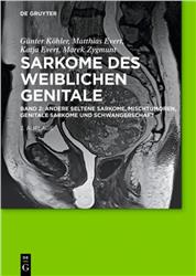 Cover Sarkome des weiblichen Genitale