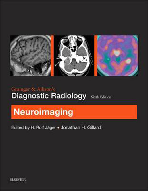 Grainger & Allison’s Diagnostic Radiology: Neuroimaging