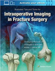 Cover Illustrated Tips and Tricks for Intraoperative Imaging in Fracture Surgery