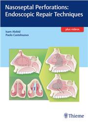 Cover Nasoseptal Perforations: Endoscopic Repair Techniques