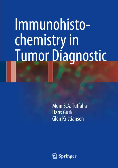 Immunohistochemistry in Tumor Diagnostic