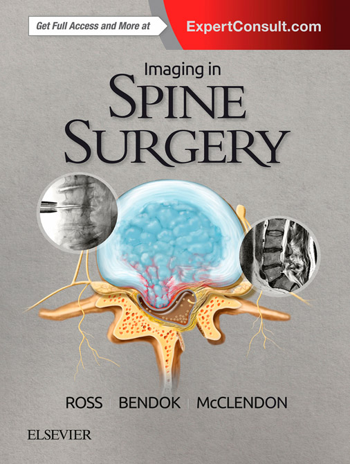 Imaging in Spine Surgery