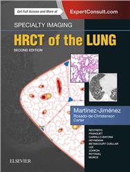 Cover Specialty Imaging: HRCT of the Lung