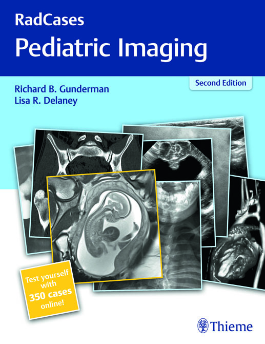 Pediatric Imaging - RadCases Plus Q&A