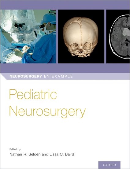 Pediatric Neurosurgery