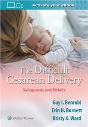 Cover The Difficult Cesarean Delivery: Safeguards and Pitfalls