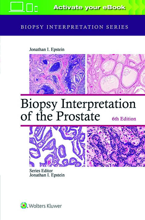 Biopsy Interpretation of the Prostate