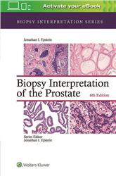 Cover Biopsy Interpretation of the Prostate